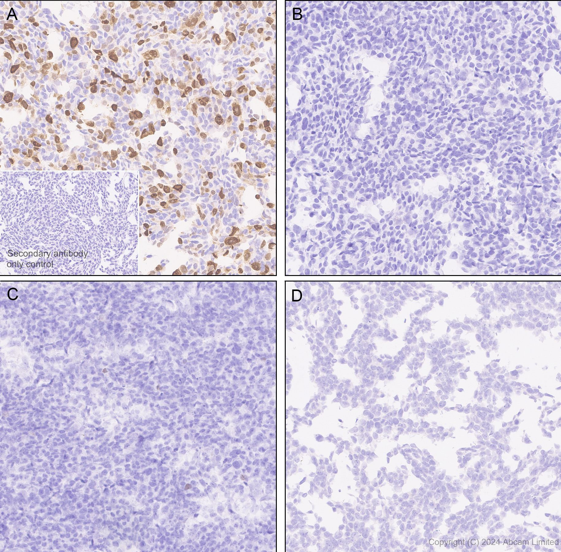 Immunohistochemistry (Formalin/PFA-fixed paraffin-embedded sections) - Anti-ER81/ETV1 antibody [DZR-1-29] (ab322139), expandable thumbnail