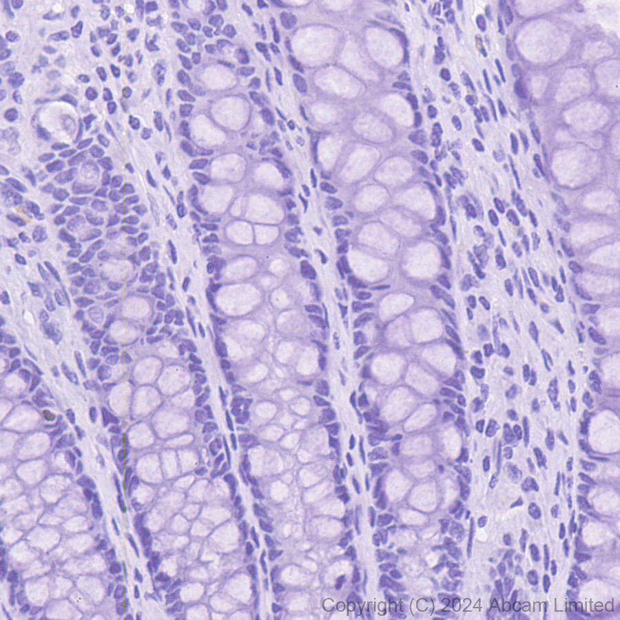 Immunohistochemistry (Formalin/PFA-fixed paraffin-embedded sections) - Anti-ER81/ETV1 antibody [DZR-1-29] (ab322139), expandable thumbnail