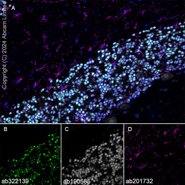 Immunohistochemistry (Frozen sections) - Anti-ER81/ETV1 antibody [DZR-1-29] (ab322139), expandable thumbnail