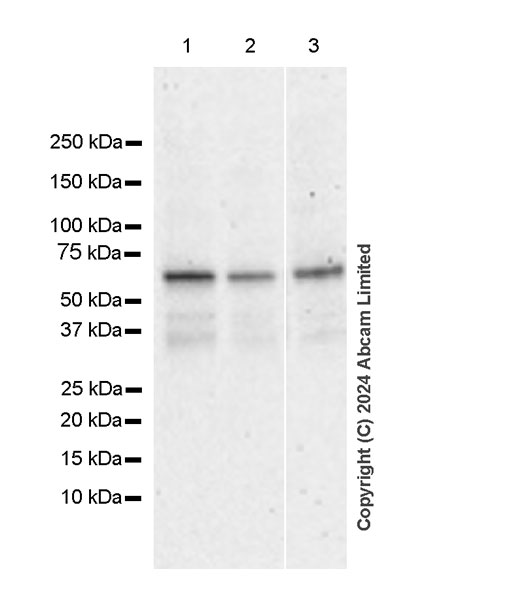 Western blot - Anti-ER81/ETV1 antibody [DZR-1-29] (AB322139), expandable thumbnail