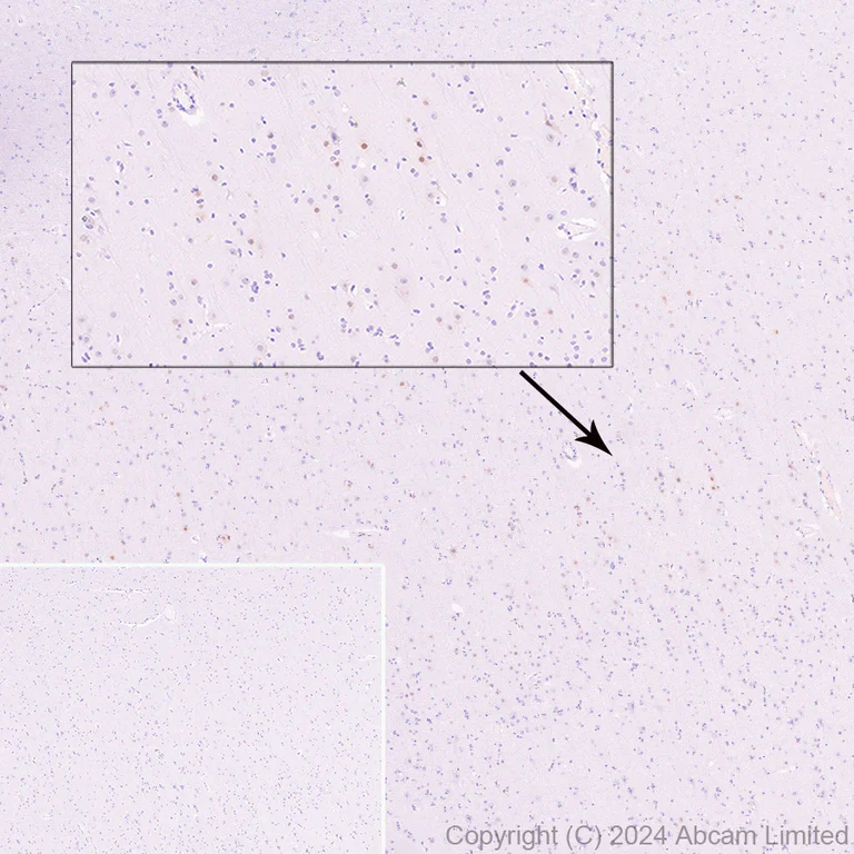 Immunohistochemistry (Formalin/PFA-fixed paraffin-embedded sections) - Anti-ER81/ETV1 antibody [DZR-1-29] - BSA and Azide free (AB324772)