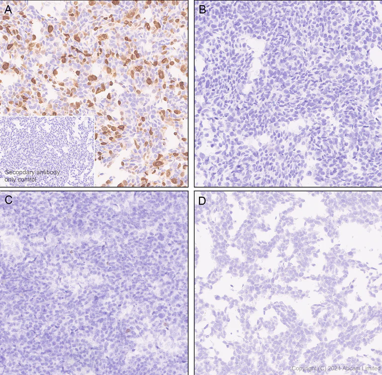 Immunohistochemistry (Formalin/PFA-fixed paraffin-embedded sections) - Anti-ER81/ETV1 antibody [DZR-1-29] - BSA and Azide free (AB324772)