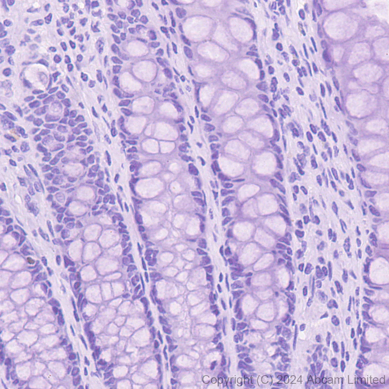 Immunohistochemistry (Formalin/PFA-fixed paraffin-embedded sections) - Anti-ER81/ETV1 antibody [DZR-1-29] - BSA and Azide free (AB324772)