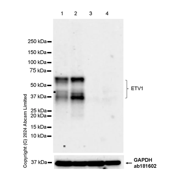 Western blot - Anti-ER81/ETV1 antibody [DZR-1-29] - BSA and Azide free (AB324772)