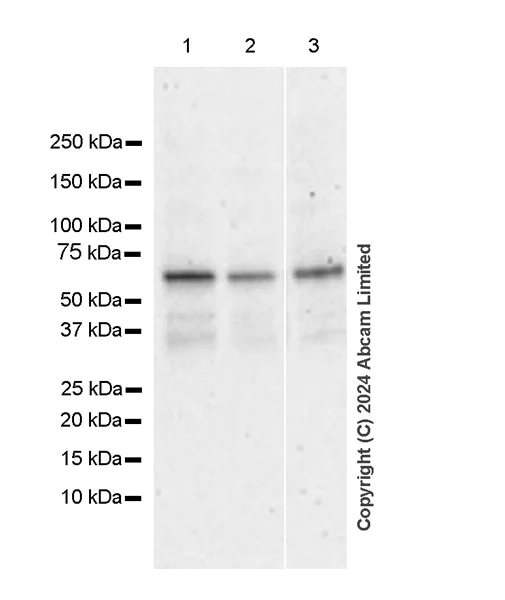 Western blot - Anti-ER81/ETV1 antibody [DZR-1-29] - BSA and Azide free (AB324772)