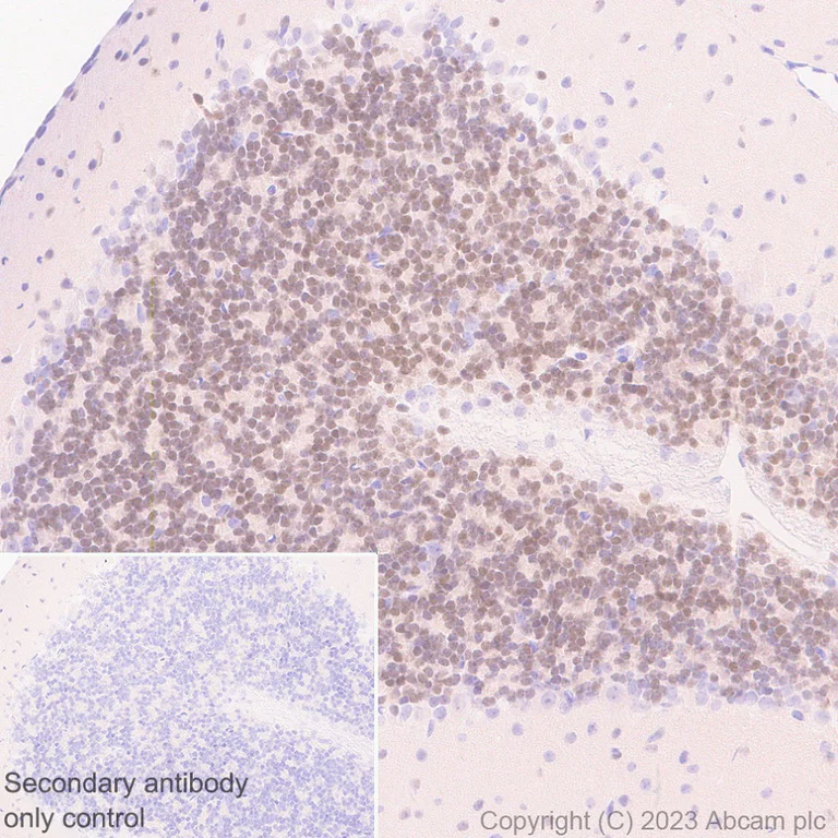 Immunohistochemistry (Formalin/PFA-fixed paraffin-embedded sections) - Anti-ER81/ETV1 antibody [EPR28393-11] - BSA and Azide free (AB313894)