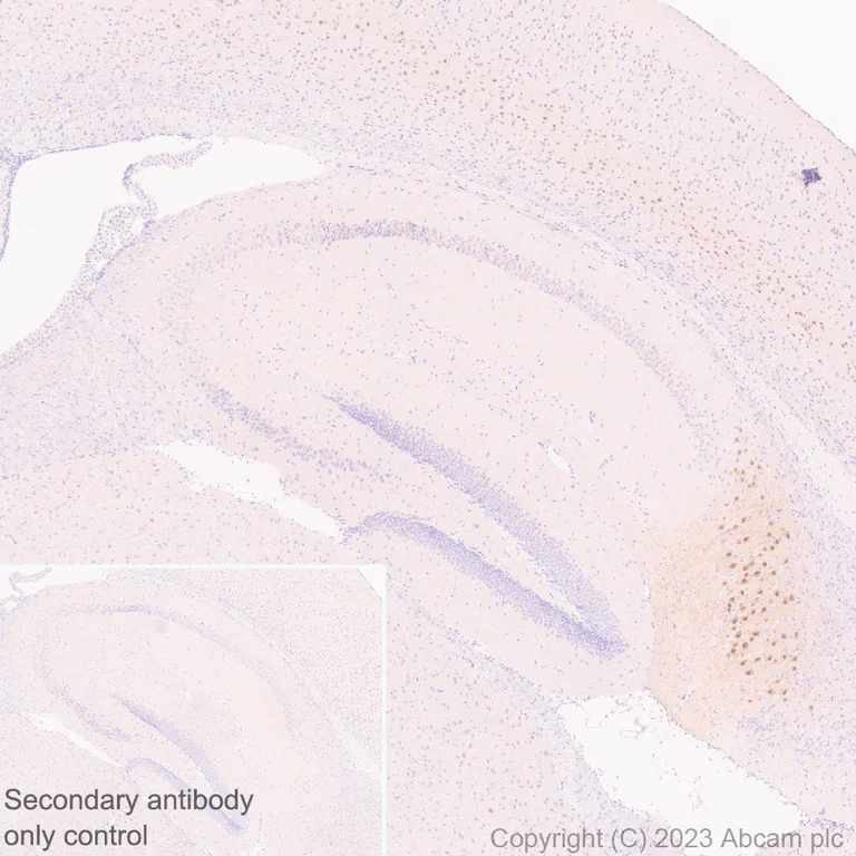 Immunohistochemistry (Formalin/PFA-fixed paraffin-embedded sections) - Anti-ER81/ETV1 antibody [EPR28393-11] - BSA and Azide free (AB313894)