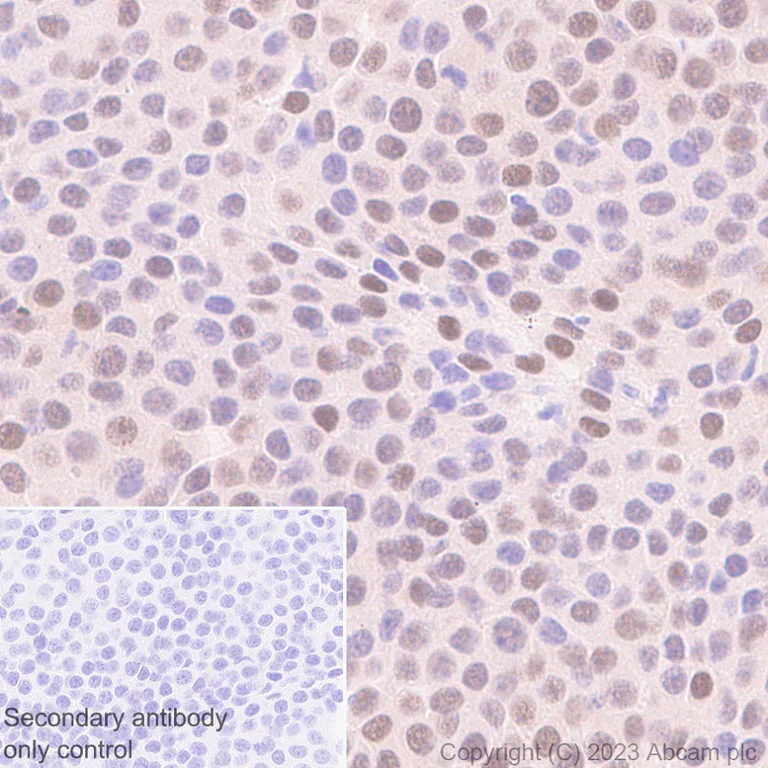 Immunohistochemistry (Formalin/PFA-fixed paraffin-embedded sections) - Anti-ER81/ETV1 antibody [EPR28393-11] - BSA and Azide free (AB313894)