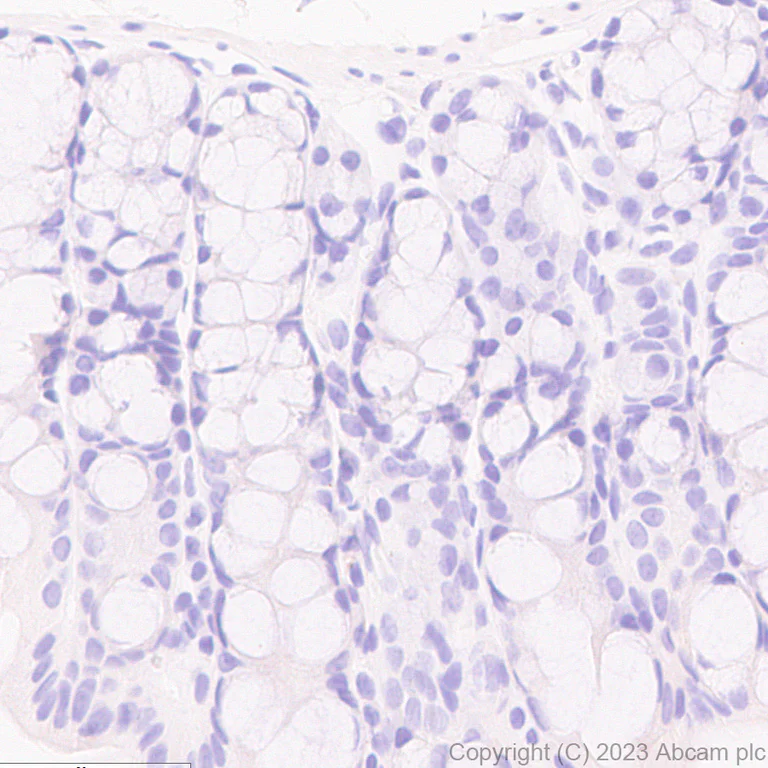 Immunohistochemistry (Formalin/PFA-fixed paraffin-embedded sections) - Anti-ER81/ETV1 antibody [EPR28393-11] - BSA and Azide free (AB313894)