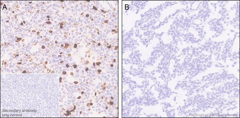 Immunohistochemistry (Formalin/PFA-fixed paraffin-embedded sections) - Anti-ER81/ETV1 antibody [EPR28393-11] - BSA and Azide free (AB313894)