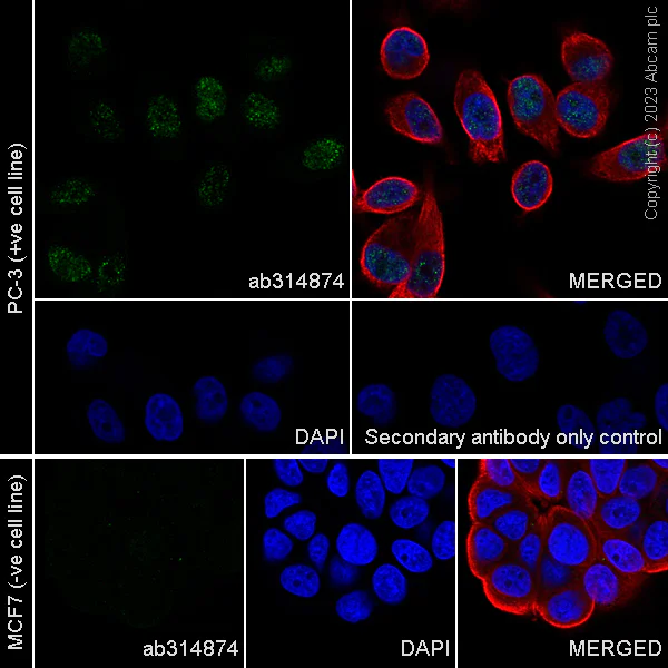 Immunocytochemistry/ Immunofluorescence - Anti-ER81/ETV1 antibody [EPR28393-132] (AB314874)