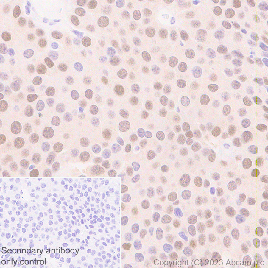 Immunohistochemistry (Formalin/PFA-fixed paraffin-embedded sections) - Anti-ER81/ETV1 antibody [EPR28393-132] (ab314874), expandable thumbnail