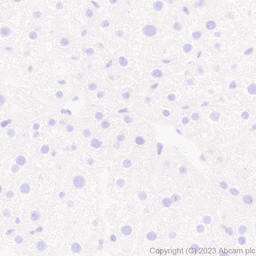Immunohistochemistry (Formalin/PFA-fixed paraffin-embedded sections) - Anti-ER81/ETV1 antibody [EPR28393-132] (AB314874), expandable thumbnail