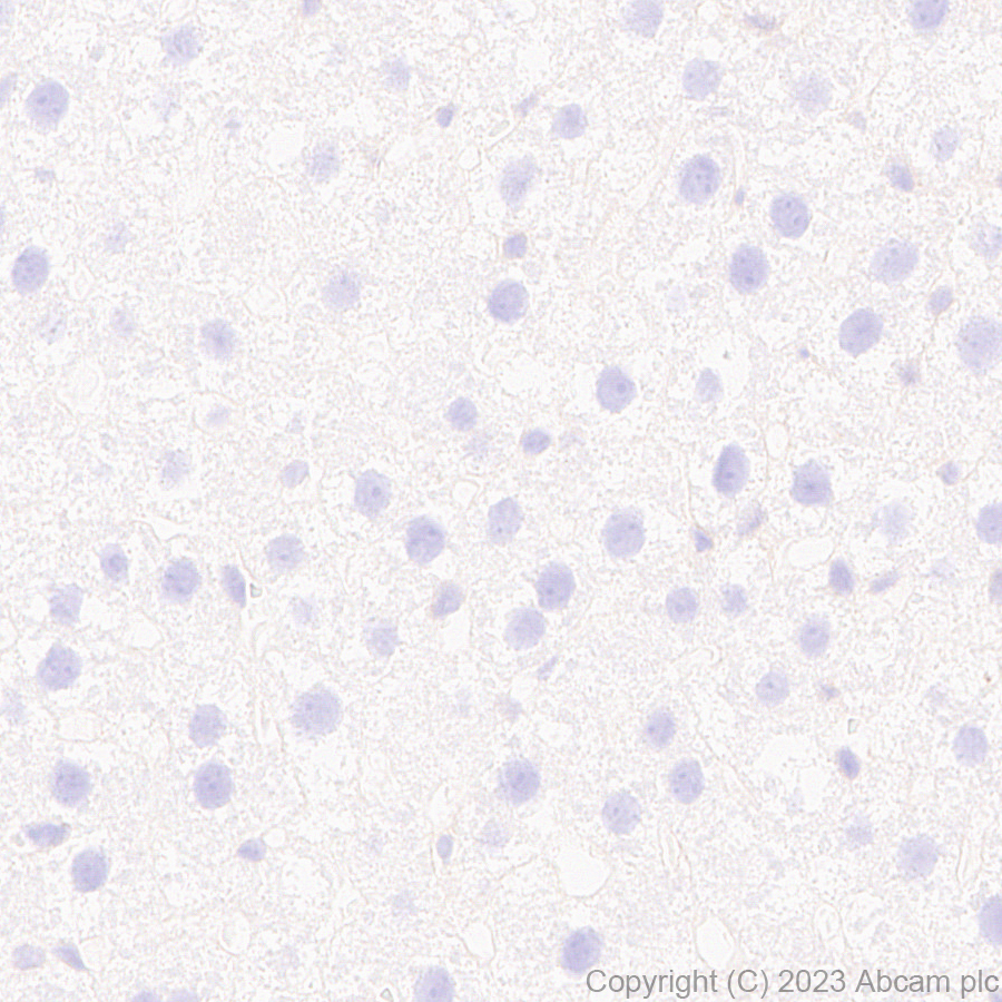Immunohistochemistry (Formalin/PFA-fixed paraffin-embedded sections) - Anti-ER81/ETV1 antibody [EPR28393-132] (AB314874), expandable thumbnail