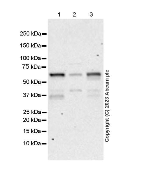 Western blot - Anti-ER81/ETV1 antibody [EPR28393-132] (AB314874), expandable thumbnail