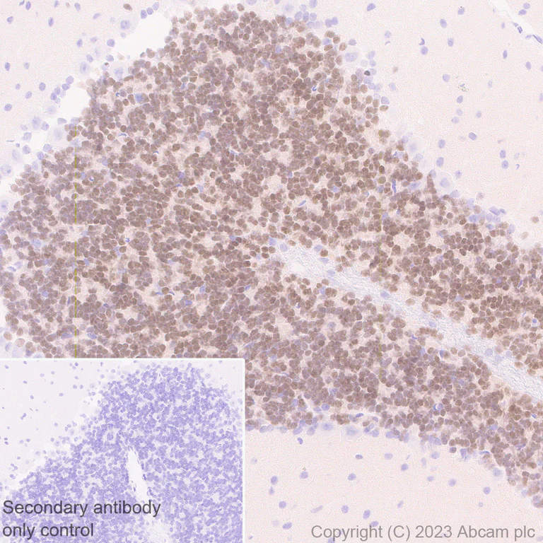 Immunohistochemistry (Formalin/PFA-fixed paraffin-embedded sections) - Anti-ER81/ETV1 antibody [EPR28393-132] - BSA and Azide free (AB314875)
