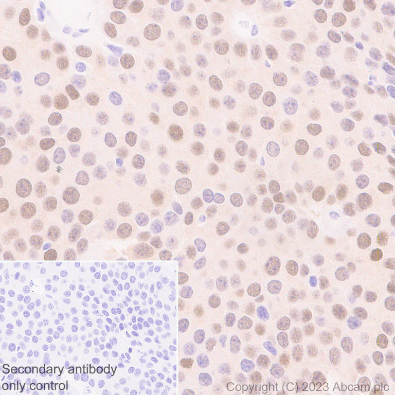Immunohistochemistry (Formalin/PFA-fixed paraffin-embedded sections) - Anti-ER81/ETV1 antibody [EPR28393-132] - BSA and Azide free (AB314875)