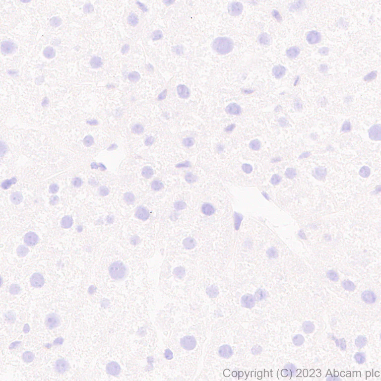 Immunohistochemistry (Formalin/PFA-fixed paraffin-embedded sections) - Anti-ER81/ETV1 antibody [EPR28393-132] - BSA and Azide free (AB314875)