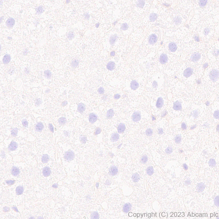 Immunohistochemistry (Formalin/PFA-fixed paraffin-embedded sections) - Anti-ER81/ETV1 antibody [EPR28393-132] - BSA and Azide free (AB314875)
