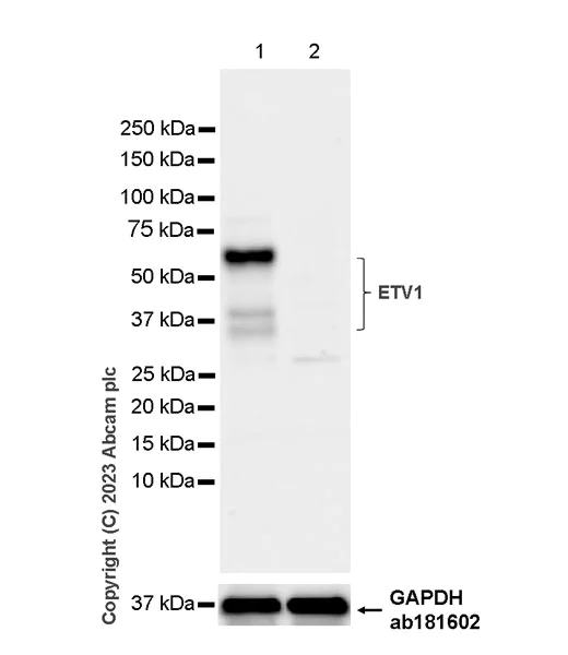 Western blot - Anti-ER81/ETV1 antibody [EPR28393-132] - BSA and Azide free (AB314875)