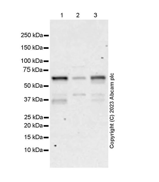 Western blot - Anti-ER81/ETV1 antibody [EPR28393-132] - BSA and Azide free (AB314875)
