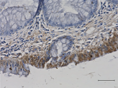 Immunohistochemistry (Formalin/PFA-fixed paraffin-embedded sections) - Anti-ERAB antibody [5F3] (AB10260)