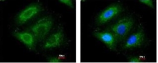 Immunocytochemistry/ Immunofluorescence - Anti-ERAB antibody (AB137455)