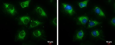 Immunocytochemistry/ Immunofluorescence - Anti-ERAB antibody (AB137455)