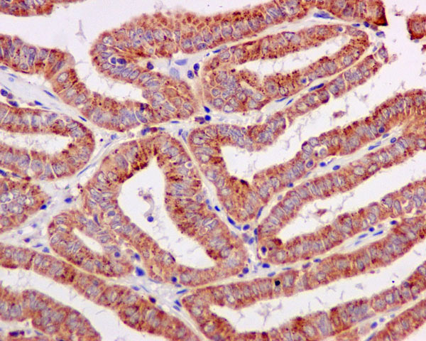 Immunohistochemistry (Formalin/PFA-fixed paraffin-embedded sections) - Anti-ERAB antibody [EPR11838(B)] (AB170864), expandable thumbnail