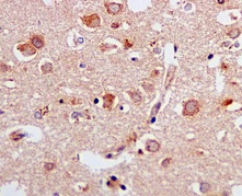 Immunohistochemistry (Formalin/PFA-fixed paraffin-embedded sections) - Anti-ERAB antibody [EPR11838(B)] (ab170864), expandable thumbnail