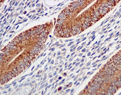 Immunohistochemistry (Formalin/PFA-fixed paraffin-embedded sections) - Anti-ERAB antibody [EPR11838(B)] (AB170864), expandable thumbnail
