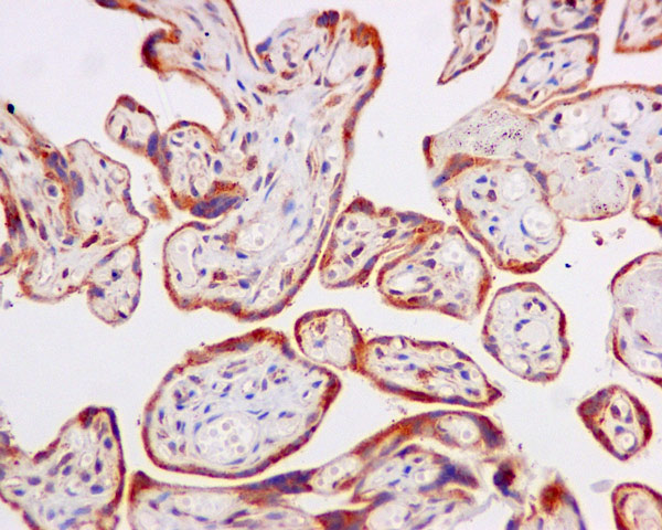 Immunohistochemistry (Formalin/PFA-fixed paraffin-embedded sections) - Anti-ERAB antibody [EPR11838(B)] (AB170864), expandable thumbnail