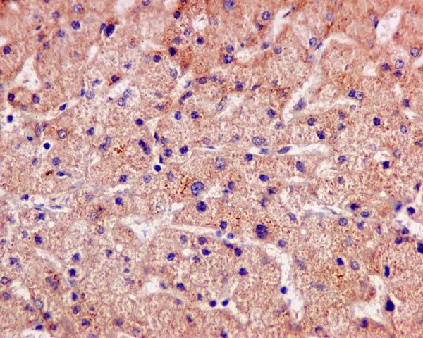 Immunohistochemistry (Formalin/PFA-fixed paraffin-embedded sections) - Anti-ERAB antibody [EPR11838(B)] (AB170864), expandable thumbnail
