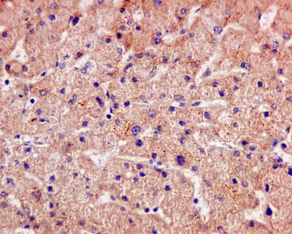 Immunohistochemistry (Formalin/PFA-fixed paraffin-embedded sections) - Anti-ERAB antibody [EPR11838(B)] (AB170864)