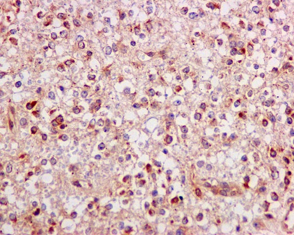 Immunohistochemistry (Formalin/PFA-fixed paraffin-embedded sections) - Anti-ERAB antibody [EPR11838(B)] (AB170864), expandable thumbnail