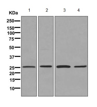 Western blot - Anti-ERAB antibody [EPR11838(B)] (ab170864), expandable thumbnail