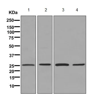 Western blot - Anti-ERAB antibody [EPR11838(B)] (AB170864)