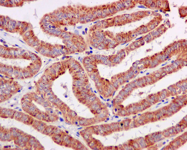 Immunohistochemistry (Formalin/PFA-fixed paraffin-embedded sections) - Anti-ERAB antibody [EPR11838(B)] - BSA and Azide free (AB249547)