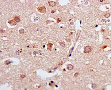 Immunohistochemistry (Formalin/PFA-fixed paraffin-embedded sections) - Anti-ERAB antibody [EPR11838(B)] - BSA and Azide free (AB249547)