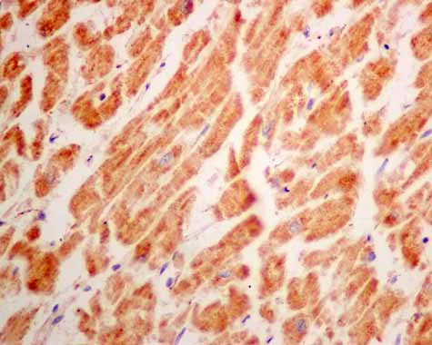Immunohistochemistry (Formalin/PFA-fixed paraffin-embedded sections) - Anti-ERAB antibody [EPR11839(B)] (AB167410)