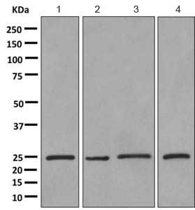 Western blot - Anti-ERAB antibody [EPR11839(B)] (AB167410)