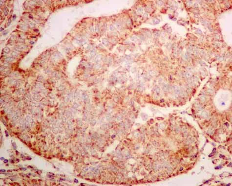 Immunohistochemistry (Formalin/PFA-fixed paraffin-embedded sections) - Anti-ERAB antibody [EPR11839(B)] - BSA and Azide free (AB249424)