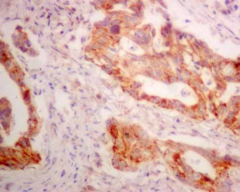Immunohistochemistry (Formalin/PFA-fixed paraffin-embedded sections) - Anti-ERAB antibody [EPR11839(B)] - BSA and Azide free (AB249424)