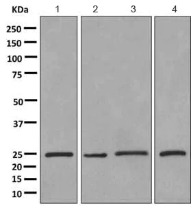 Western blot - Anti-ERAB antibody [EPR11839(B)] - BSA and Azide free (AB249424)
