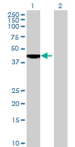 Western blot - Anti-ERAP2 antibody (AB69037)