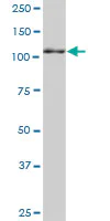Western blot - Anti-ERAP2 antibody (AB69037)