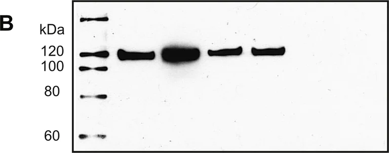 Western blot - Anti-ERAP2 antibody (AB69037)