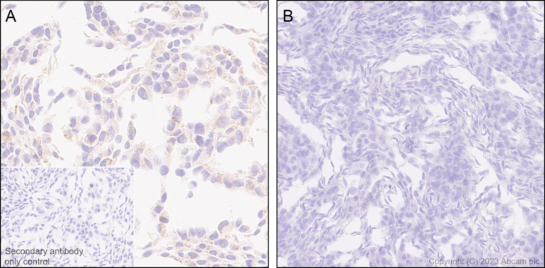 Immunohistochemistry (Formalin/PFA-fixed paraffin-embedded sections) - Anti-ERAP2 antibody [EPR26475-10] (AB313567), expandable thumbnail