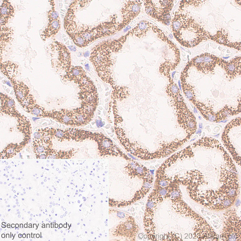 Immunohistochemistry (Formalin/PFA-fixed paraffin-embedded sections) - Anti-ERAP2 antibody [EPR26475-10] - BSA and Azide free (AB313568)