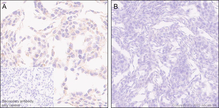 Immunohistochemistry (Formalin/PFA-fixed paraffin-embedded sections) - Anti-ERAP2 antibody [EPR26475-10] - BSA and Azide free (AB313568)